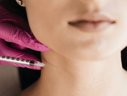 biorevitalisaatio Joensuussa