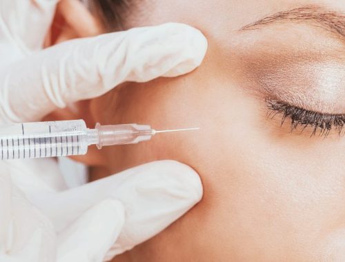 silmänympärysihon biorevitalisaatio